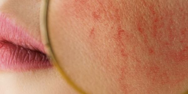 <div class="tm-source-woo-price price"><del aria-hidden="true"><span class="woocommerce-Price-amount amount"><bdi><span class="woocommerce-Price-currencySymbol">CHF</span> 150.00</bdi></span></del> <span class="screen-reader-text">Le prix initial était : CHF 150.00.</span><ins aria-hidden="true"><span class="woocommerce-Price-amount amount"><bdi><span class="woocommerce-Price-currencySymbol">CHF</span> 105.00</bdi></span></ins><span class="screen-reader-text">Le prix actuel est : CHF 105.00.</span></div>