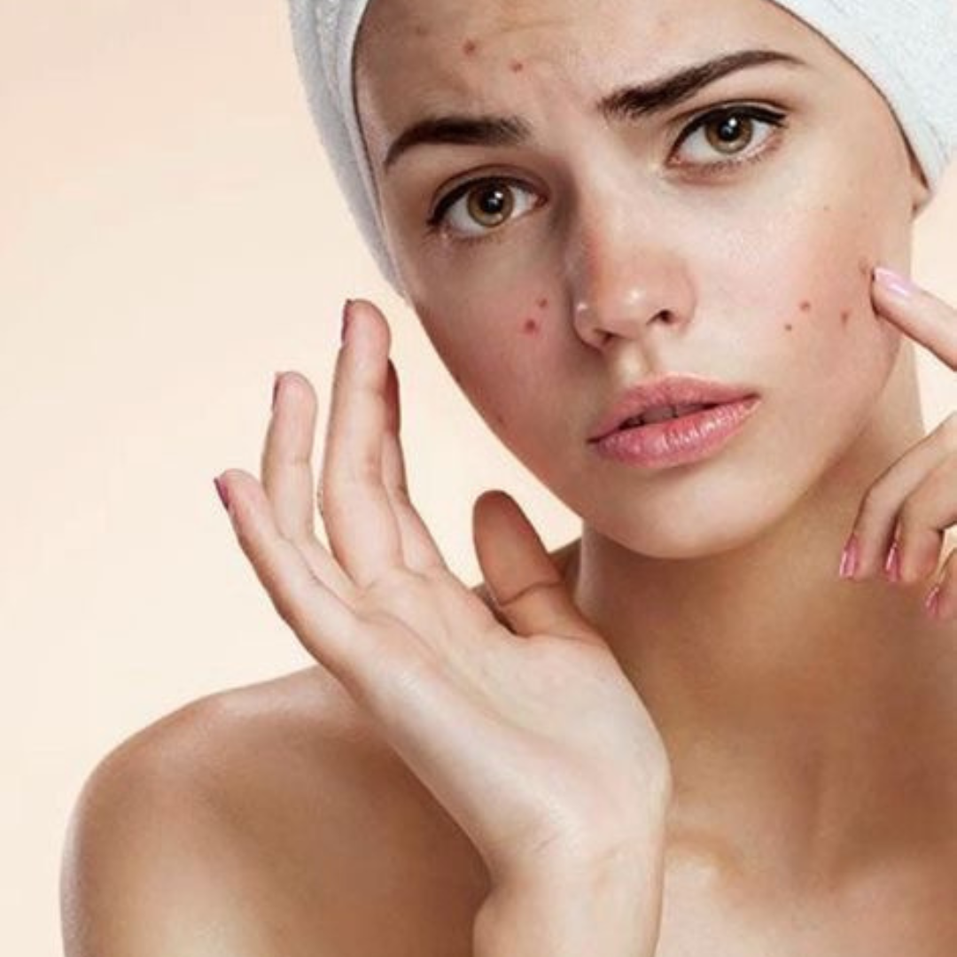 Soin visage adolescents