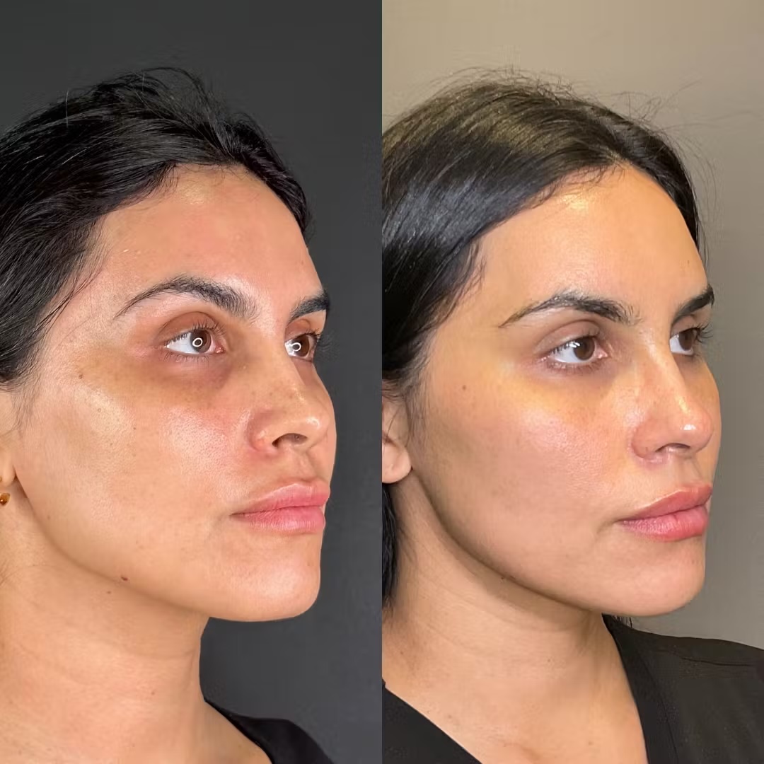hydrafacial lausanne