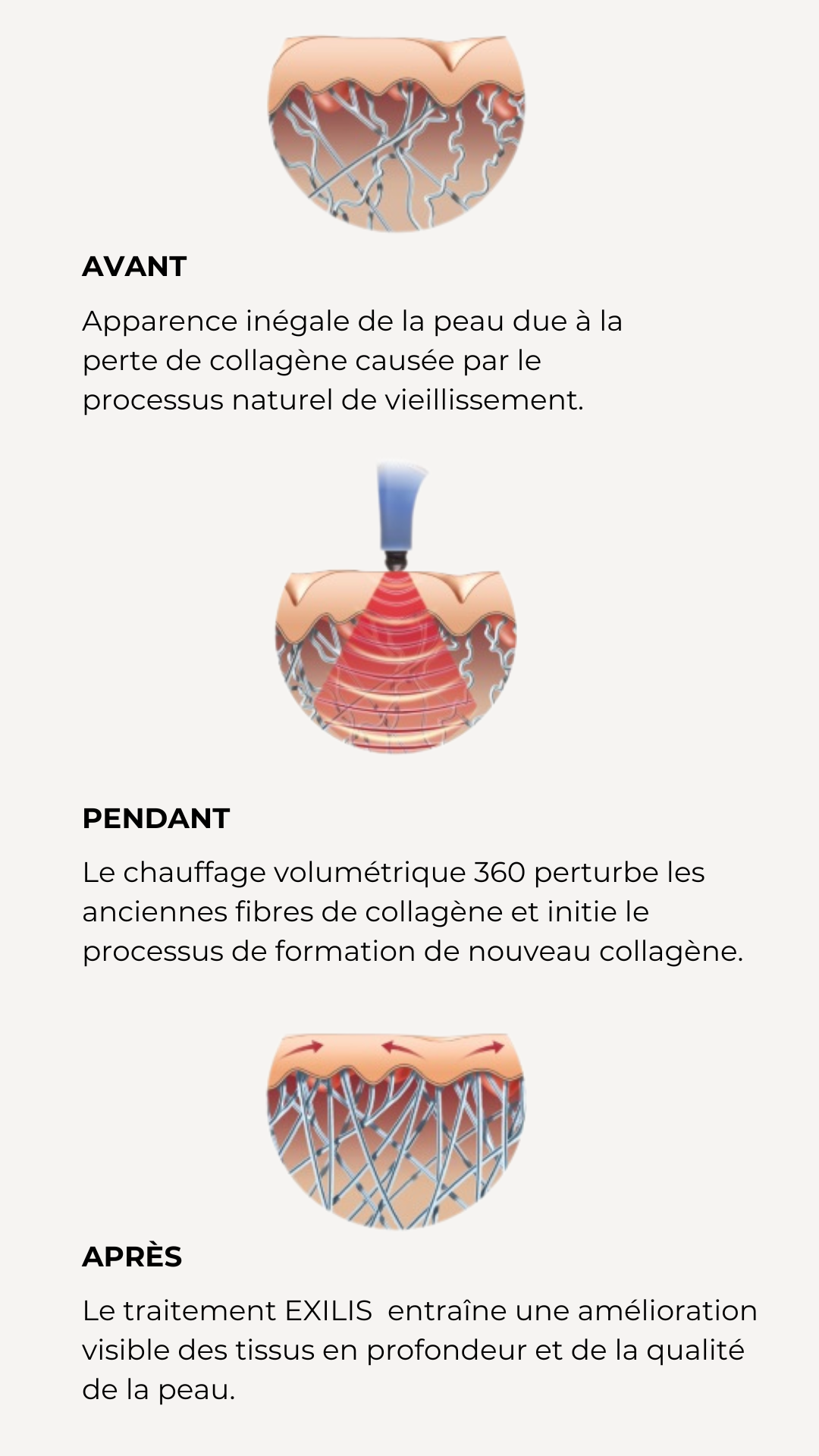 Elixis