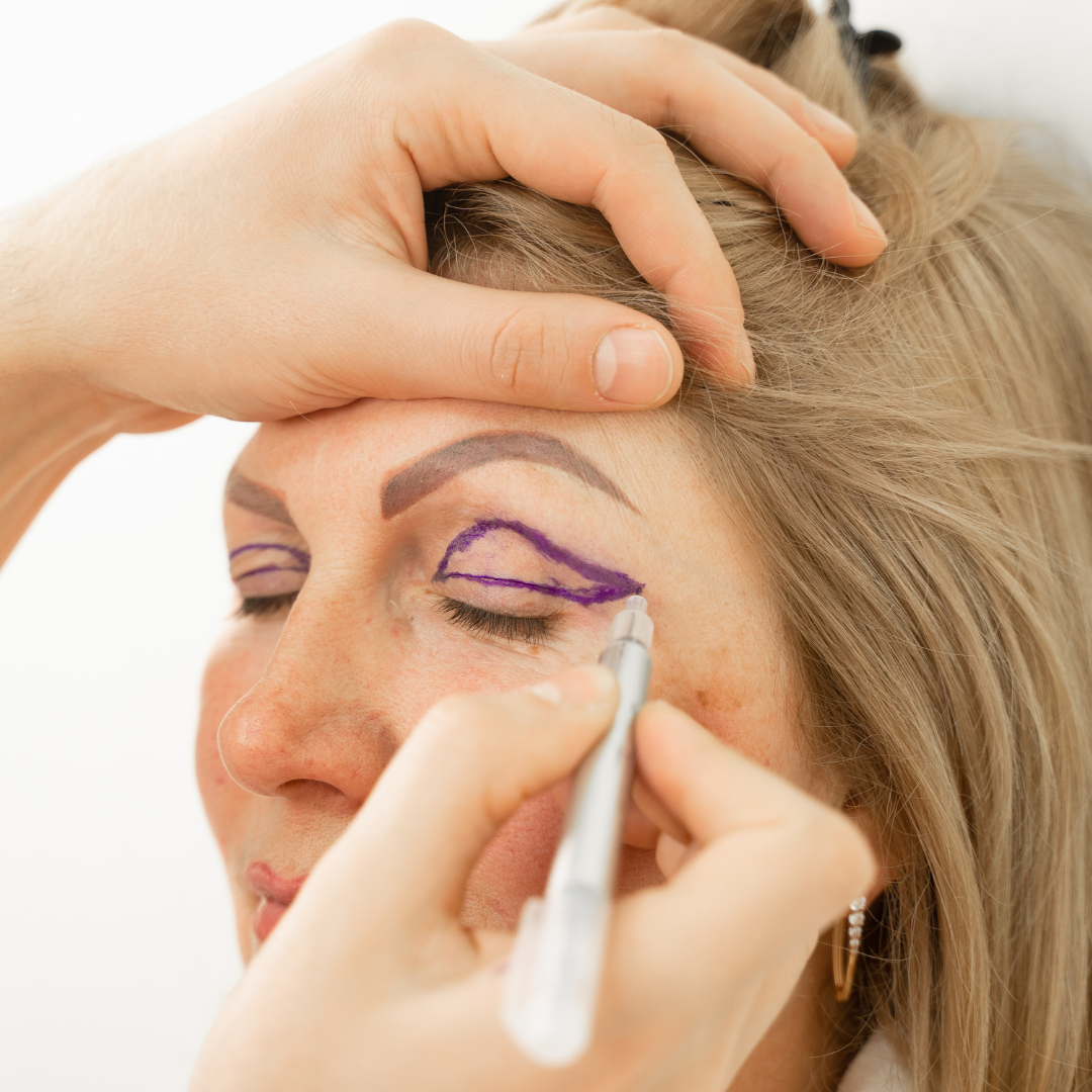 Blépharoplastie sans chirurgie