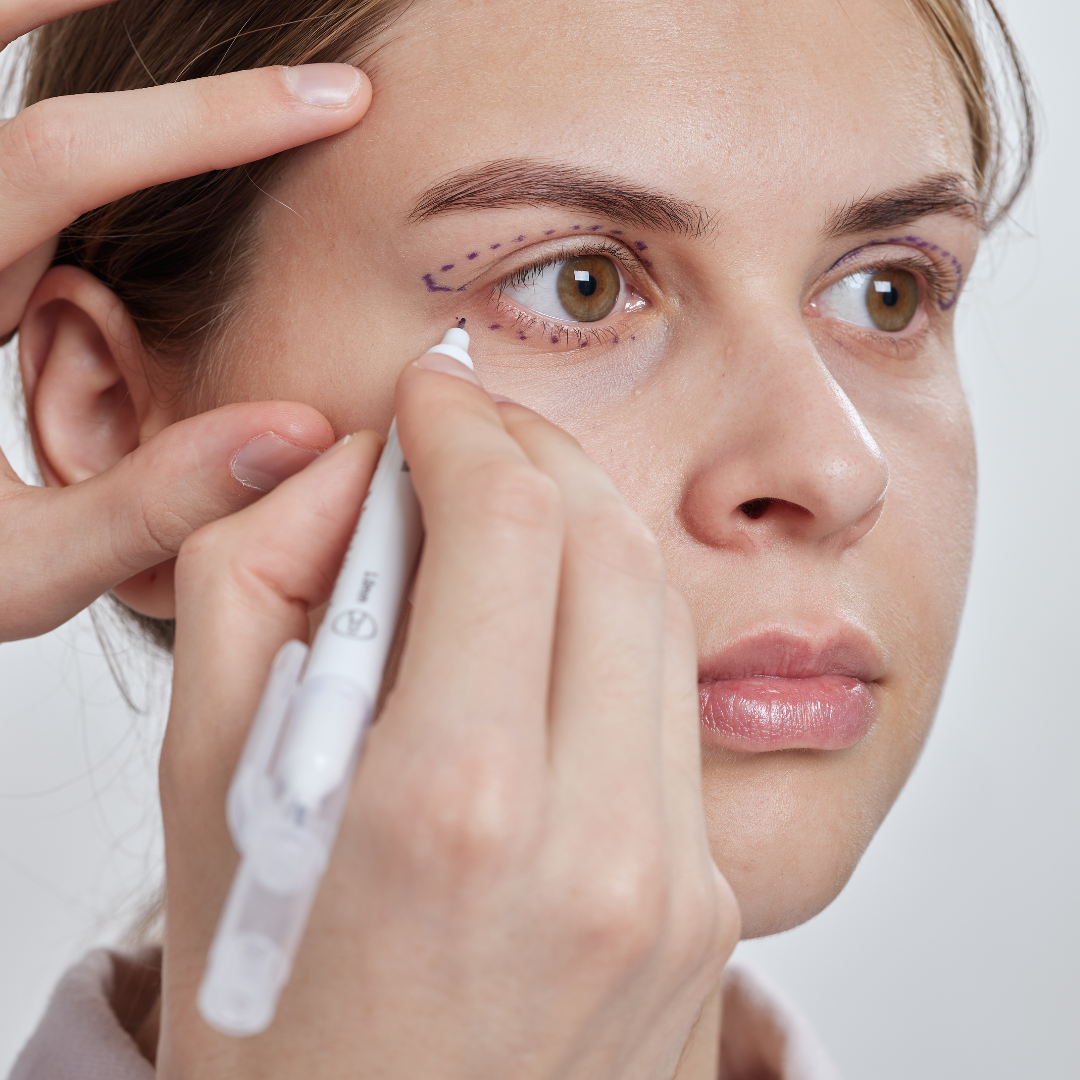 Blépharoplastie sans chirurgie