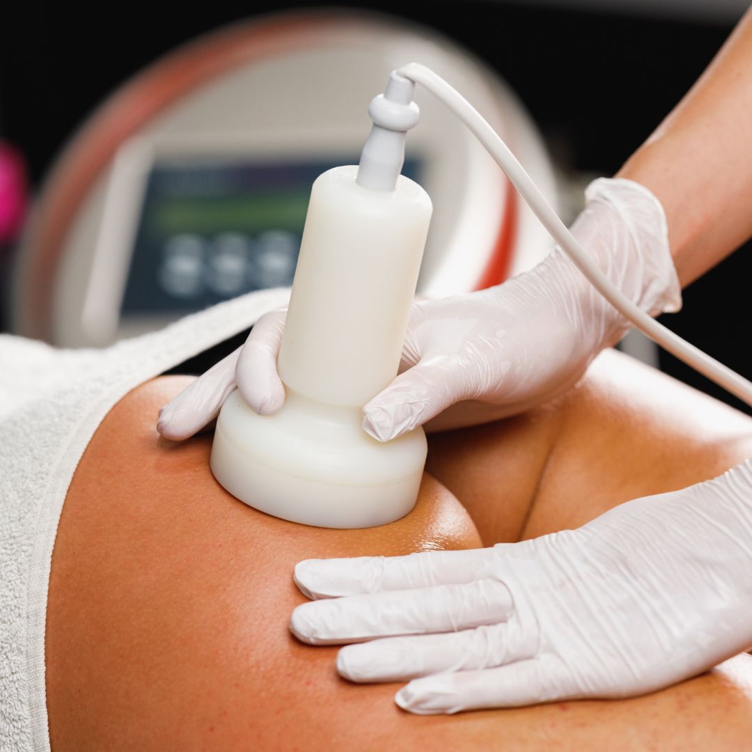 Lipocavitation