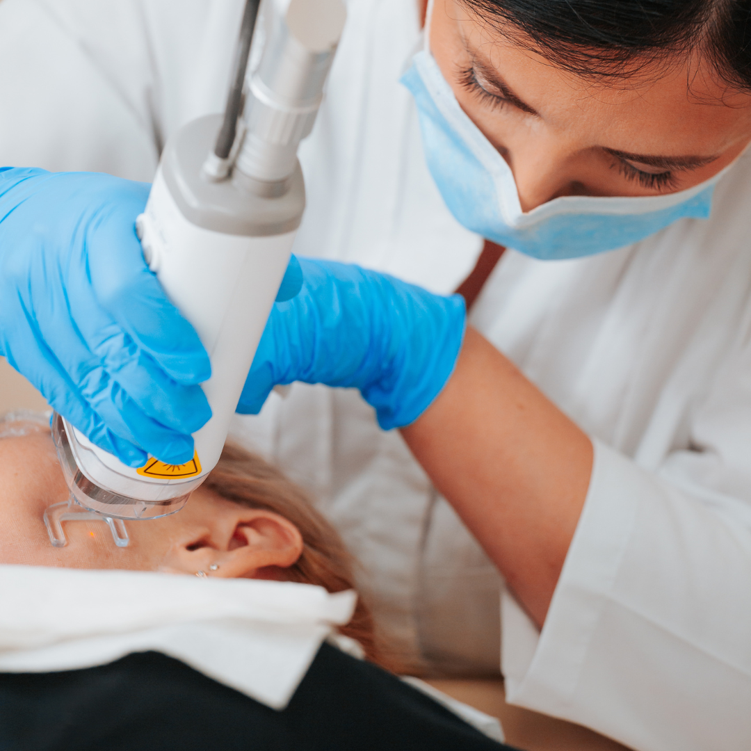 microneedling fractionné
