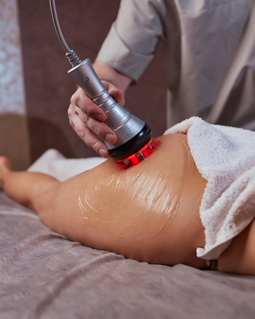 risques lipocaviation
