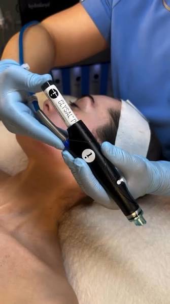 Hydrafacial JLO Beauty