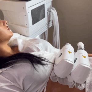 cryolipolyse lausanne