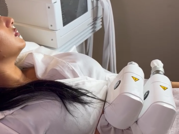 cryolipolyse lausanne