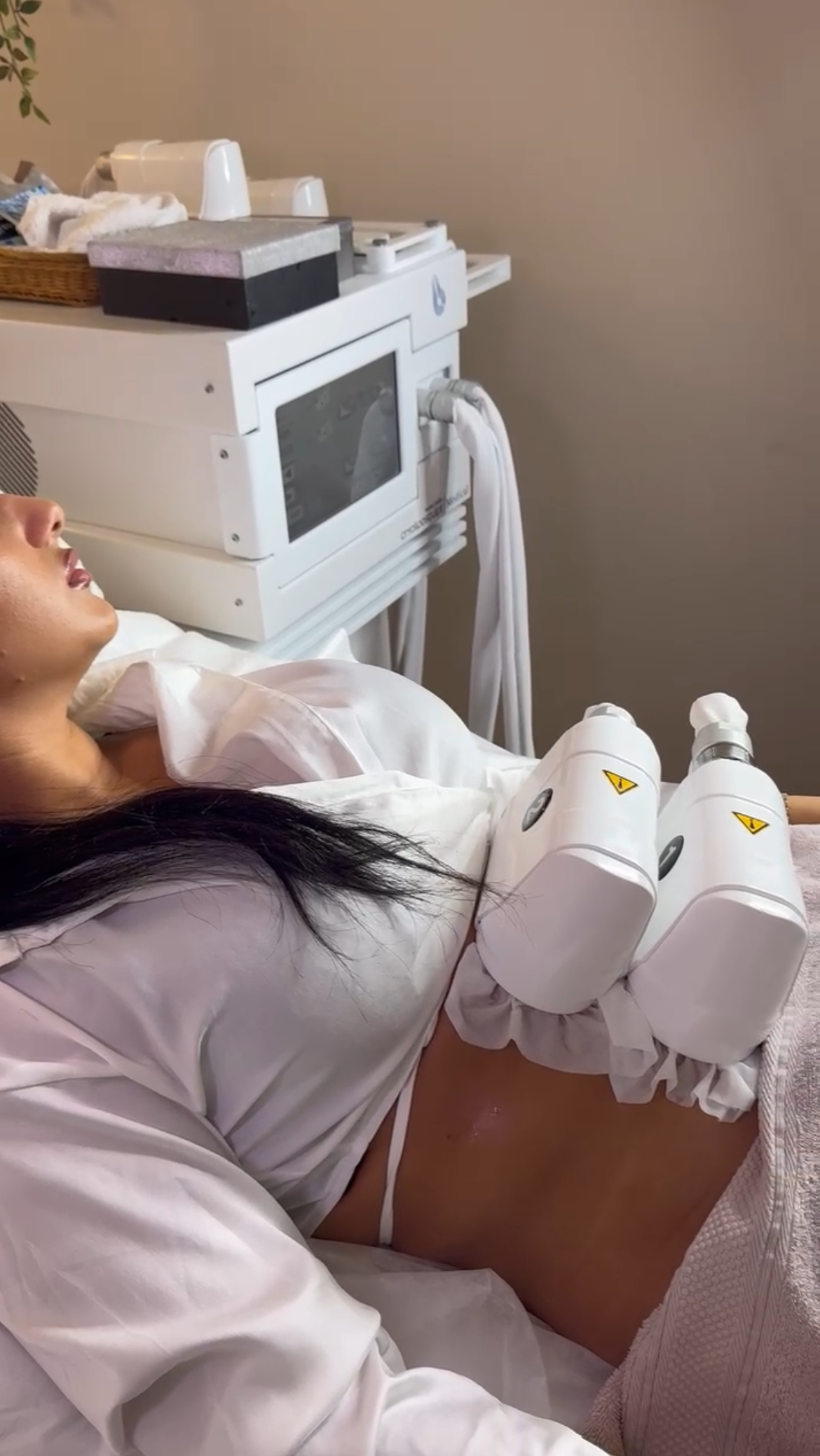 cryolipolyse lausanne