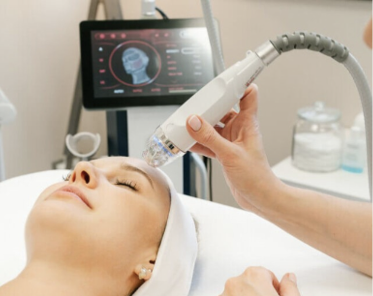 Radiofréquence et Micro-Aiguilles : Soin Secret RF