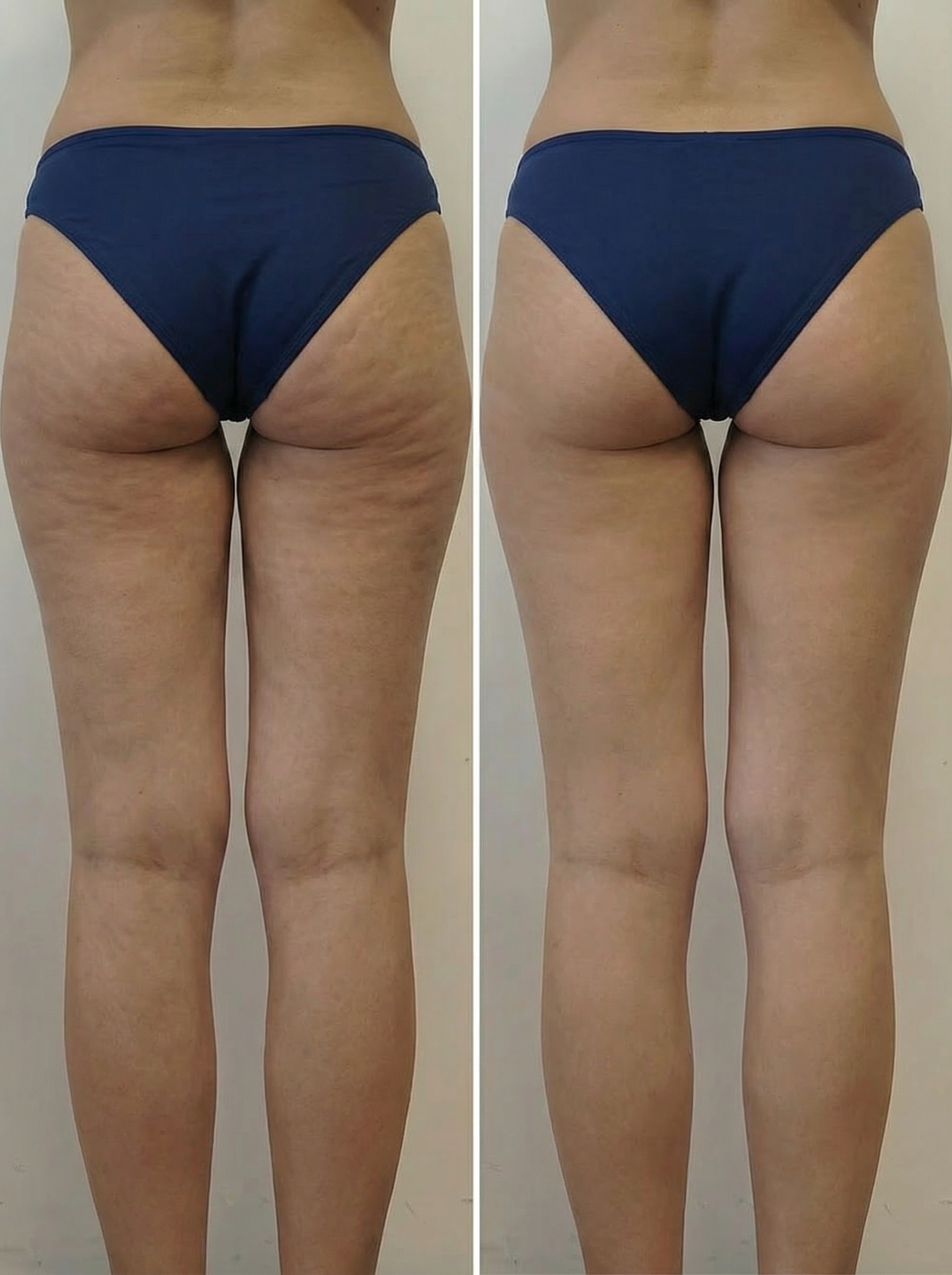 Après la cure Zéro Complexe — Maison Evenia Lausanne