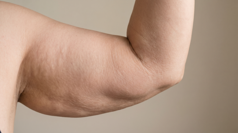 Bras relâchés — Endosphères Maison Evenia