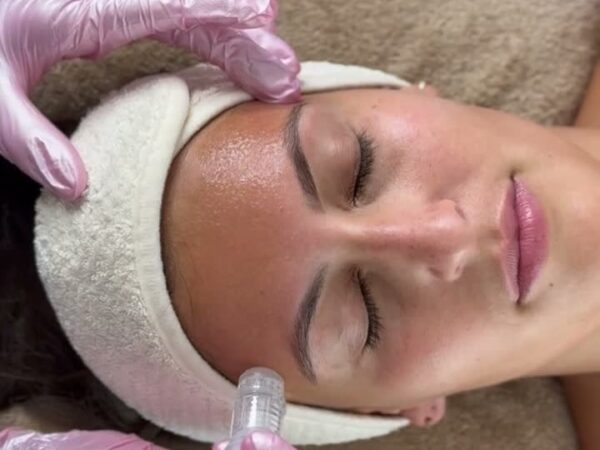 Soin visage au Dermapen à Maison Evenia, Lausanne