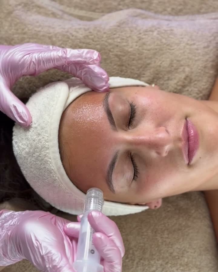 Microneedling Dermapen, HydraNeedling et cures visage à Lausanne