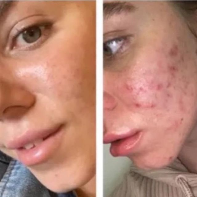 Tesla Med avant après