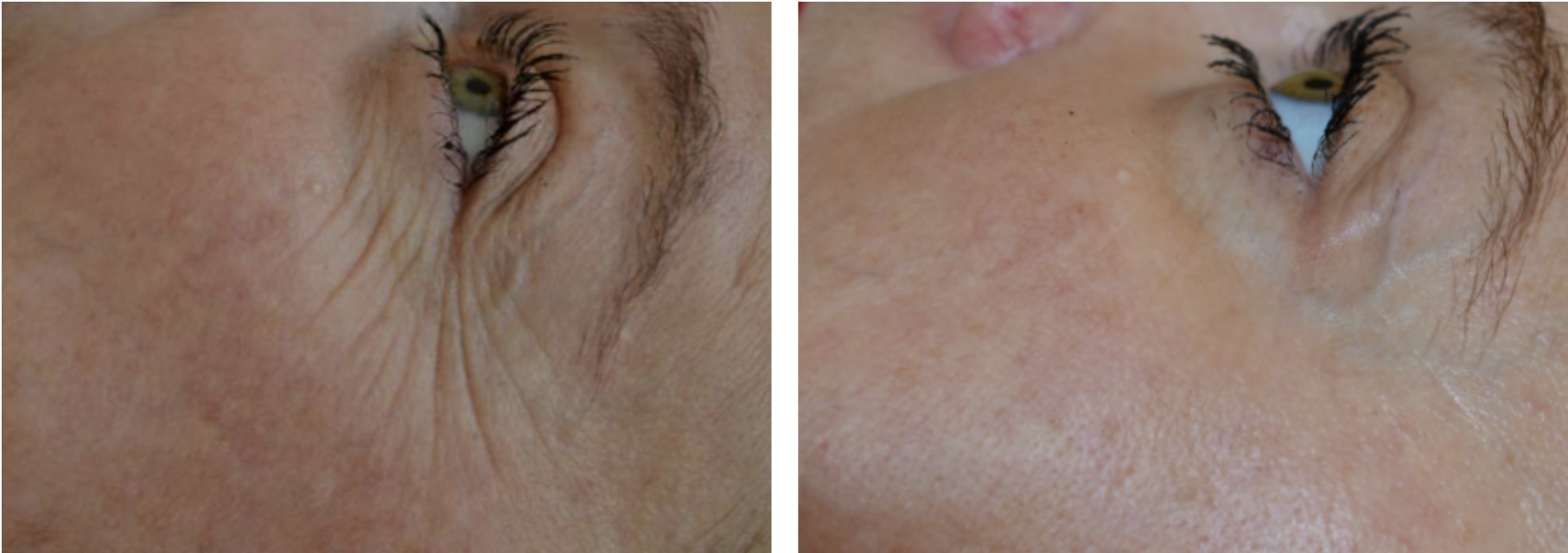 Elixis visage lausanne