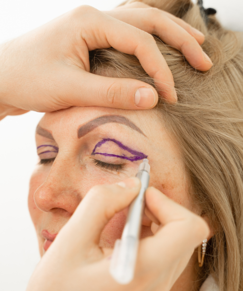 Blépharoplastie sans chirurgie