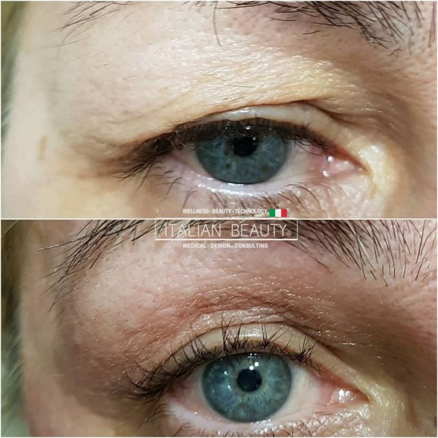 Tesla Med avant apr&egrave;s