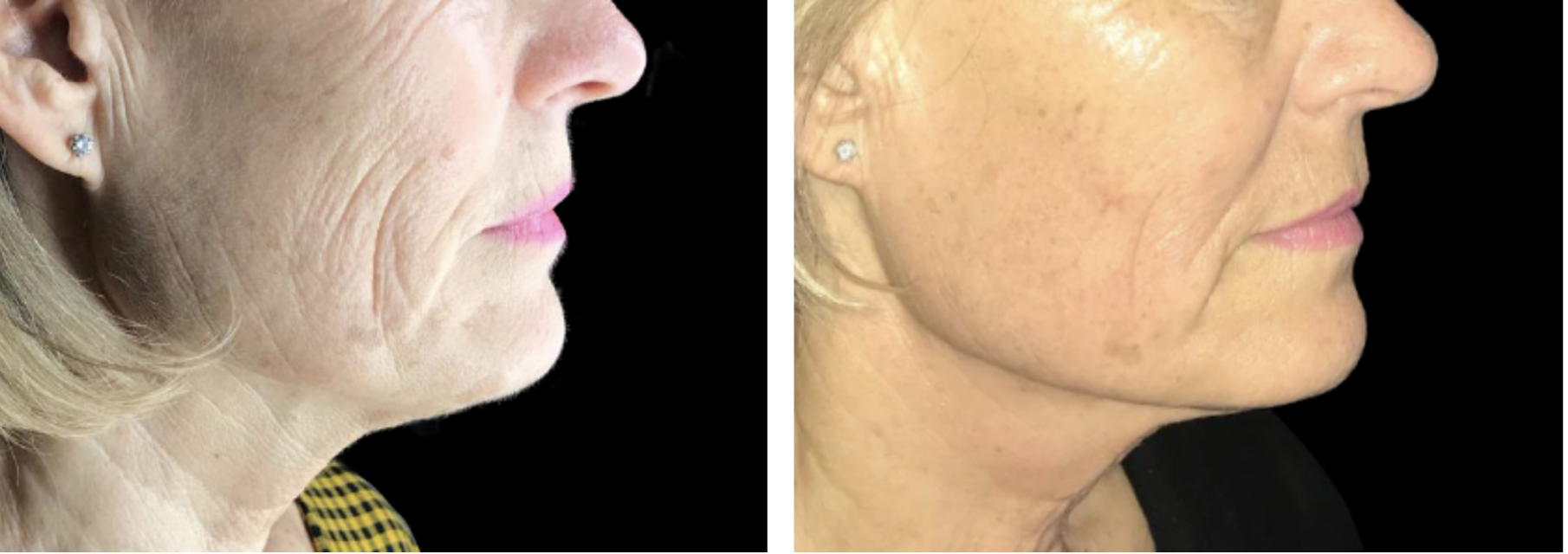 elixis elite lausanne