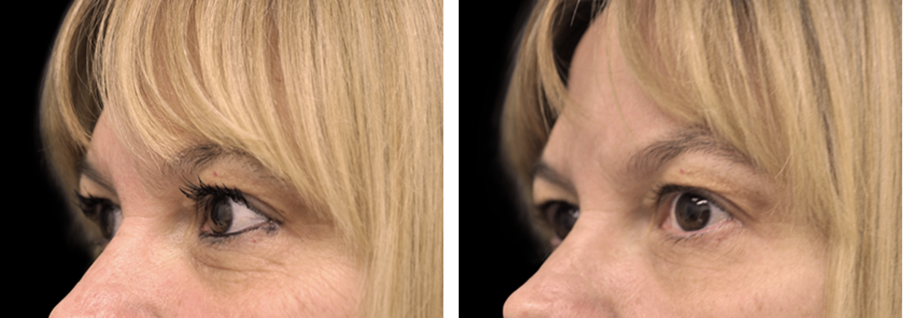 Elixis visage lausanne