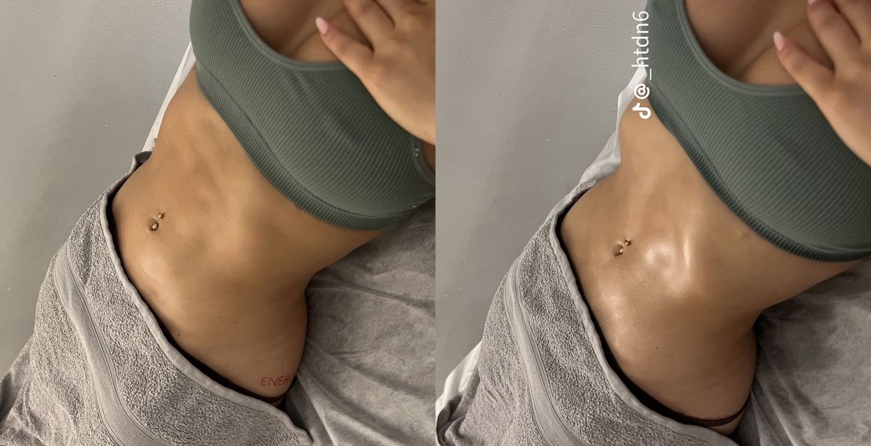 drainage lymphatique