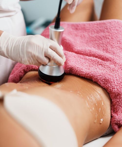 Radiofréquence et Micro-Aiguilles : Soin Secret RF