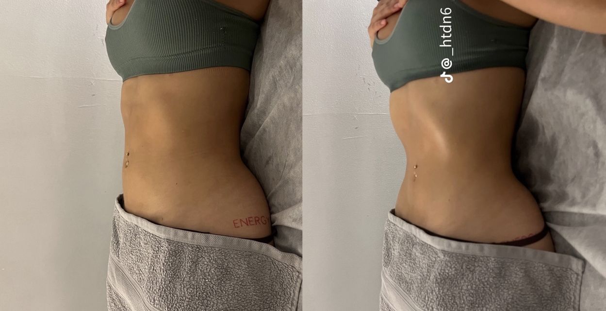 drainage lymphatique