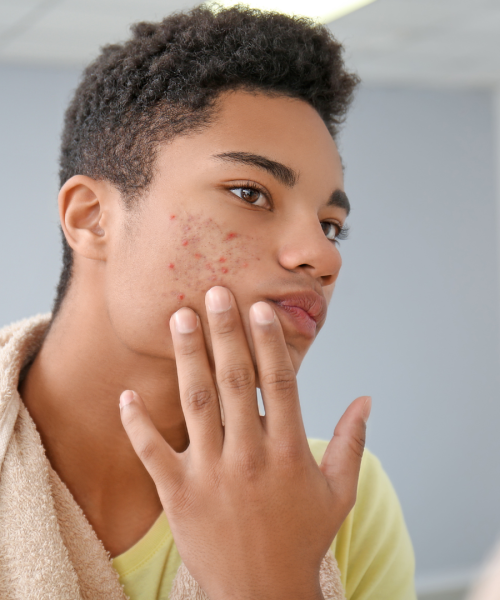 Soin visage adolescents